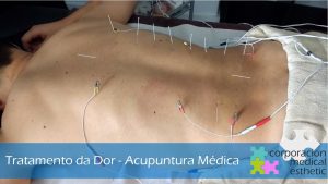 acupuntura em braga